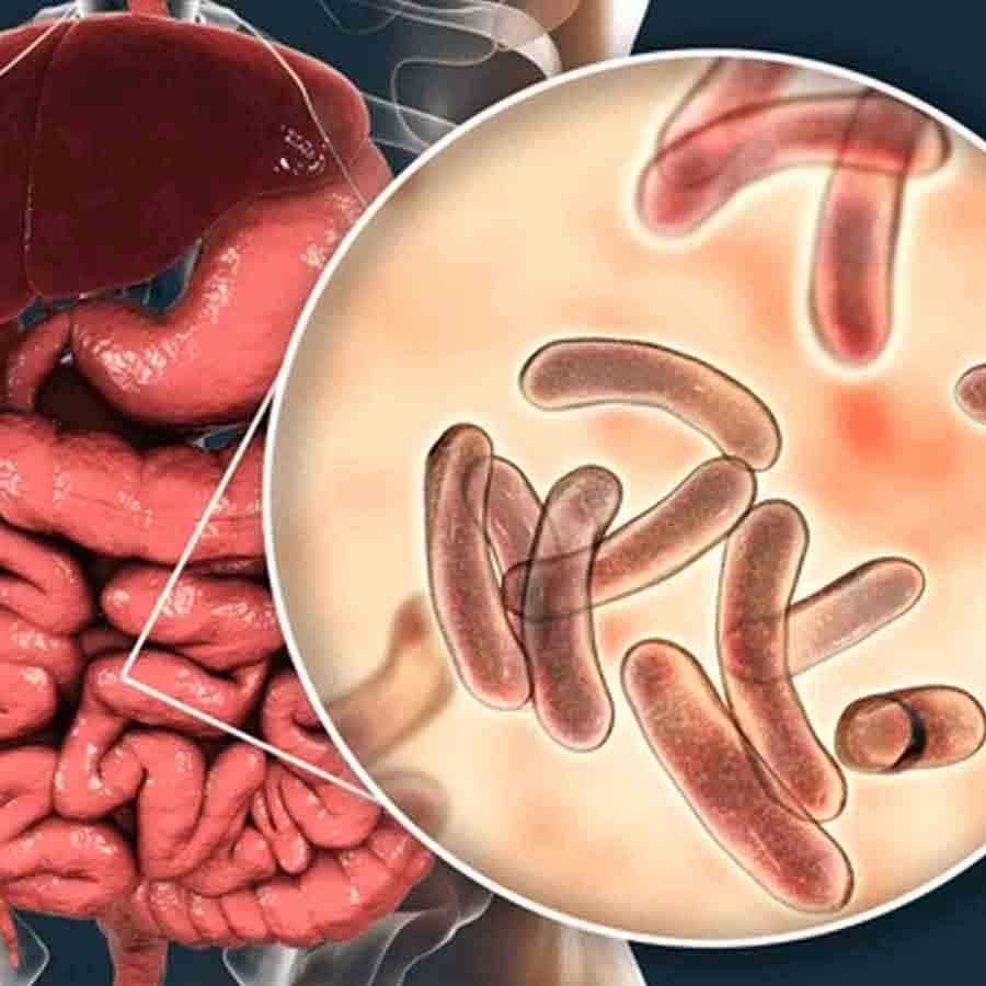 কলকাতায় ফের কলেরা! আক্রান্ত হয়ে হাসপাতালে ভর্তি চার বছরের শিশুকন্যা